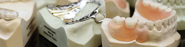 Removable Archives - Ultimate Dental, Denture, Crown & Implants Lab